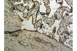 Immunohistochemistry (IHC) image for anti-Neurotrophic Tyrosine Kinase, Receptor, Type 2 (NTRK2) (AA 32-430) antibody (ABIN1983470)