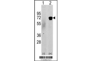 Western blot analysis of CAMKK2 using rabbit polyclonal CAMKK2 Antibody (N-term G67) using 293 cell lysates (2 ug/lane) either nontransfected (c) or transiently transfected with the CAMKK2 gene (Lane 2). (CAMKK2 anticorps  (N-Term))