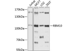 Western blot analysis of extracts of various cell lines, using RBM10 antibody (ABIN1682489, ABIN3018697, ABIN3018698 and ABIN6220546) at 1:1000 dilution. (RBM10 anticorps  (AA 1-180))