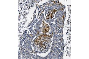 IHC analysis of AFAP/AFAP1 using anti-AFAP/AFAP1 antibody (ABIN7601861). (AFAP anticorps  (AA 498-730))