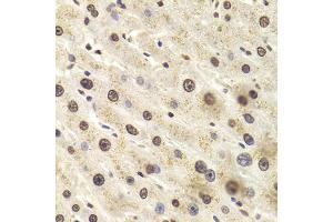 Immunohistochemistry of paraffin-embedded human liver injury using HNRNPD Antibody (ABIN5970929) at dilution of 1/100 (40x lens). (HNRNPD/AUF1 anticorps)
