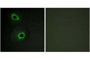Immunofluorescence analysis of COS7 cells, using Collagen VII alpha1 Antibody. (COL7A1 anticorps  (AA 1841-1890))
