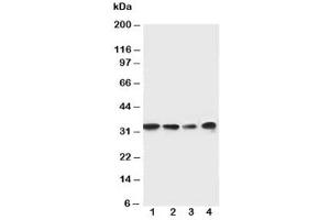 Western blot testing of MyD88 antibody and Lane 1:  rat spleen (MYD88 anticorps  (Middle Region))