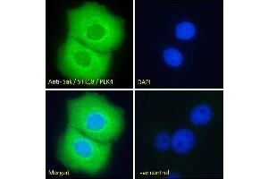 ABIN184701 Immunofluorescence analysis of paraformaldehyde fixed A431 cells, permeabilized with 0. (PLK4 anticorps  (N-Term))