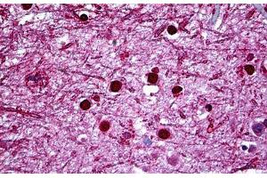 Human Brain, Cortex: Formalin-Fixed, Paraffin-Embedded (FFPE) (HMX2 anticorps  (AA 125-224))