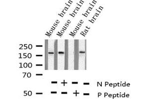 Western blot analysis of Phospho-NMDAR2B (Tyr1474) expression in various lysates