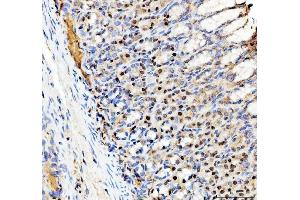 IHC analysis of SP6 using anti-SP6 antibody (ABIN5692945). (SP6 anticorps)