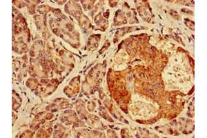 Immunohistochemistry of paraffin-embedded human pancreatic tissue using ABIN7142027 at dilution of 1:100 (AGPAT3 anticorps  (AA 148-304))