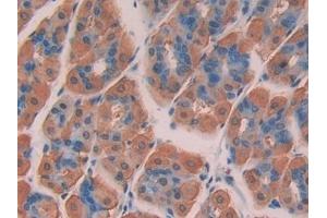 Detection of CHD3 in Mouse Stomach Tissue using Polyclonal Antibody to Chromodomain Helicase DNA Binding Protein 3 (CHD3)