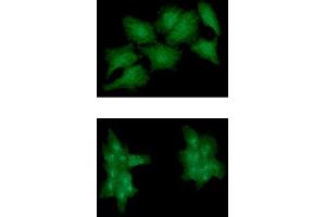 ICC/IF analysis of EPHA2 in HeLa cell line, stained monoclonal anti-human EPHA2 antibody (1:100) with goat anti-mouse IgG-Alexa fluor 488 conjugate (Green).