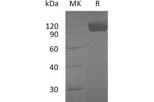 Western Blotting (WB) image for TYRO3 Protein Tyrosine Kinase (TYRO3) protein (Fc Tag) (ABIN7320679)