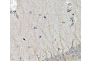 Immunohistochemistry of paraffin-embedded Rat brain using PSMB10 Polyclonal Antibody at dilution of 1:200 (40x lens).