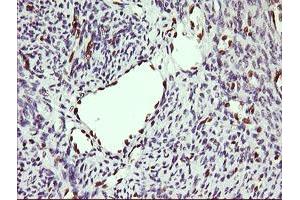 Image no. 2 for anti-ERG, ETS transcription factor (ERG) antibody (ABIN1498075)