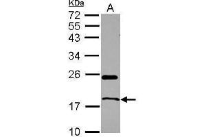 WB Image Sample (30 ug of whole cell lysate) A: U87-MG 12% SDS PAGE antibody diluted at 1:1000 (RNASE1 anticorps  (Center))