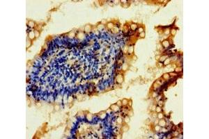 Immunohistochemistry of paraffin-embedded human small intestine tissue using ABIN7168450 at dilution of 1:100 (FTSJ2 anticorps  (AA 19-246))