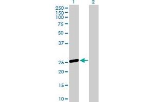 Western Blot analysis of OSTF1 expression in transfected 293T cell line by OSTF1 MaxPab polyclonal antibody. (OSTF1 anticorps  (AA 1-217))