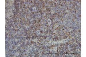 Image no. 1 for anti-SH2 Domain Containing 3C (SH2D3C) (AA 1-111) antibody (ABIN599111) (SH2D3C anticorps  (AA 1-111))
