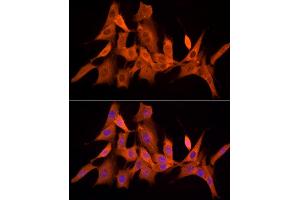 Immunofluorescence analysis of NIH/3T3 cells using PSMC5 Rabbit mAb (ABIN7269585) at dilution of 1:50 (40x lens). (PSMC5 anticorps)