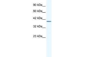 WB Suggested Anti-ANXA13 Antibody Titration:  2. (Annexin A13 anticorps  (N-Term))