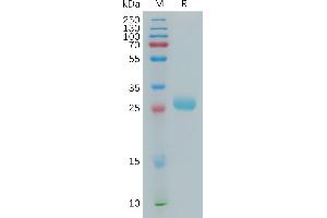 Human A2 Protein, His Tag on SDS-PAGE under reducing condition.