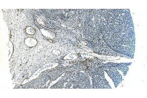 IHC analysis of H Cadherin/CDH13 using anti-H Cadherin/CDH13 antibody (ABIN7600095).