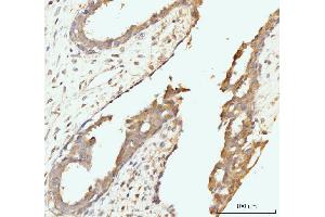 IHC analysis of Golgin 97/GOLGA1 using anti-Golgin 97/GOLGA1 antibody (ABIN7599539). (GOLGA1 anticorps  (AA 1-752))