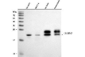 Western blot analysis of STMN3 using anti-STMN3 antibody (ABIN7600886).
