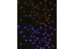 Immunofluorescence analysis of U-2 OS cells using Snail antibody (ABIN1682836, ABIN3019402, ABIN3019403, ABIN3019404 and ABIN6220883) at dilution of 1:100.
