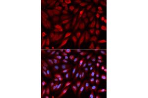 Immunofluorescence analysis of U2OS cells using Syntenin antibody (ABIN6132381, ABIN6147469, ABIN6147470 and ABIN6220999). (SDCBP anticorps  (AA 1-260))