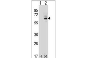 Western blot analysis of FASTK (arrow) using rabbit polyclonal FASTK Antibody (C-term) (ABIN656397 and ABIN2845692).