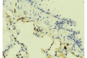 ABIN6273906 at 1/100 staining Mouse lung tissue by IHC-P.