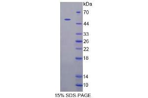 SDS-PAGE analysis of Human CADPS Protein. (CADPS Protéine)