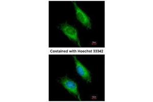 ICC/IF Image Immunofluorescence analysis of methanol-fixed HeLa, using FAST , antibody at 1:200 dilution.