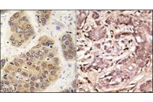 Image no. 2 for anti-Small Ubiquitin Related Modifier 4 (SUMO4) (Wild Type) antibody (ABIN356786)