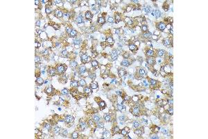 Immunohistochemistry of paraffin-embedded rat liver using Cytochrome P450 4A (CYP4) (CYP4) Rabbit mAb (ABIN7266658) at dilution of 1:100 (40x lens).