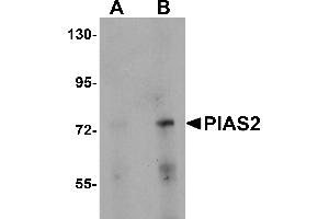 Western Blotting (WB) image for anti-Protein Inhibitor of Activated STAT, 2 (PIAS2) (N-Term) antibody (ABIN1031511) (PIAS2 anticorps  (N-Term))
