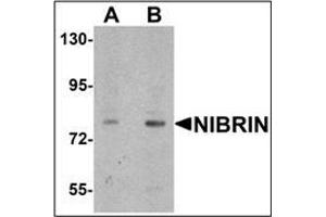 Western blot analysis of NIBRIN in rat lung tissue lysate with NIBRIN antibody (N-term) Cat. (Nibrin anticorps  (N-Term))