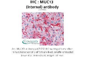 Image no. 2 for anti-Mucin 13, Cell Surface Associated (MUC13) (Internal Region) antibody (ABIN1737140) (MUC13 anticorps  (Internal Region))