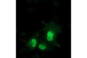 Immunofluorescence (IF) image for anti-EPM2A (Laforin) Interacting Protein 1 (EPM2AIP1) antibody (ABIN1498041) (EPM2AIP1 anticorps)