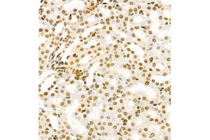 Immunohistochemistry of paraffin embedded mouse kidney using HIF-3α (ABIN7074273) at dilution of 1:1600 (400x lens)