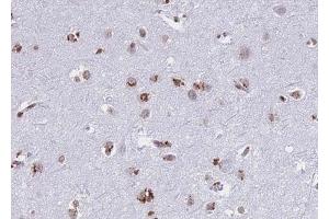 ABIN6268739 at 1/100 staining human brain tissue sections by IHC-P. (Cathepsin D anticorps  (C-Term))