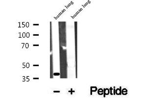 Western blot analysis of extracts of human lung tissue, using ACAA1 antibody.
