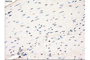 Immunohistochemical staining of paraffin-embedded prostate tissue using anti-MAP2K1 mouse monoclonal antibody. (MEK1 anticorps)