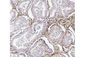 IHC analysis of Collagen III/COL3A1 using anti-Collagen III/COL3A1 antibody (ABIN6719296).