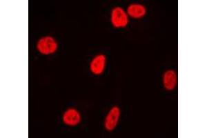 Immunofluorescent analysis of Ku80 staining in HeLa cells.