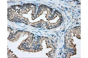 Immunohistochemical staining of paraffin-embedded pancreas tissue using anti-CAPZA1 mouse monoclonal antibody. (CAPZA1 anticorps)