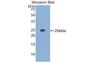 Detection of Recombinant SMC3, Human using Polyclonal Antibody to Structural Maintenance Of Chromosomes Protein 3 (SMC3) (SMC3 anticorps  (AA 994-1181))