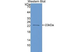 Western Blotting (WB) image for anti-Fast Skeletal Troponin I (TNNI2) (AA 1-182) antibody (ABIN1078623) (TNNI2 anticorps  (AA 1-182))