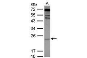 Image no. 2 for anti-Cytoglobin (CYGB) (AA 1-190) antibody (ABIN1501883) (CYGB anticorps  (AA 1-190))