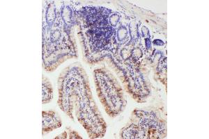 IHC analysis of IL-18 using anti- IL-18 antibody .